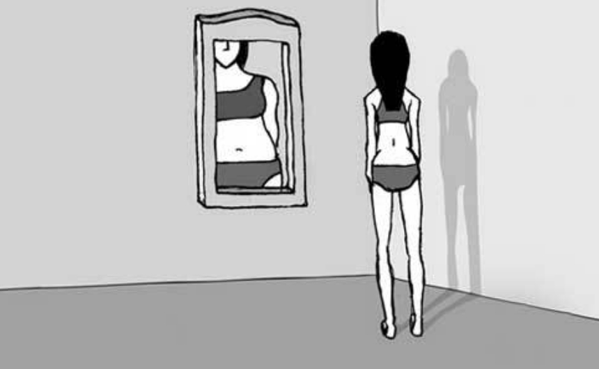 22 Yaşındaki Anoreksia Hastasının Kurtuluş Öyküsü